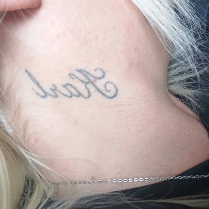 Old name tattoo on the neck, before